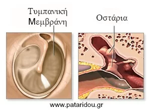 otosklirinsi-2